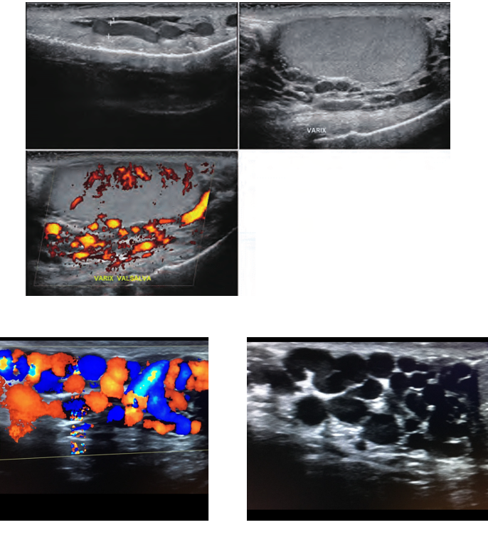 <p>what does this image show</p>