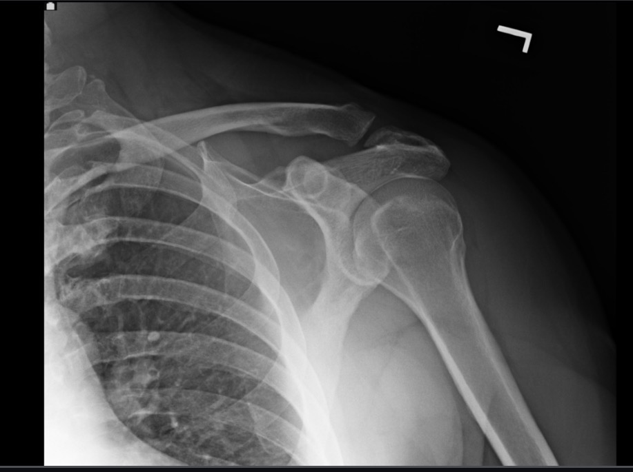 <p>What projection position is this image?</p>