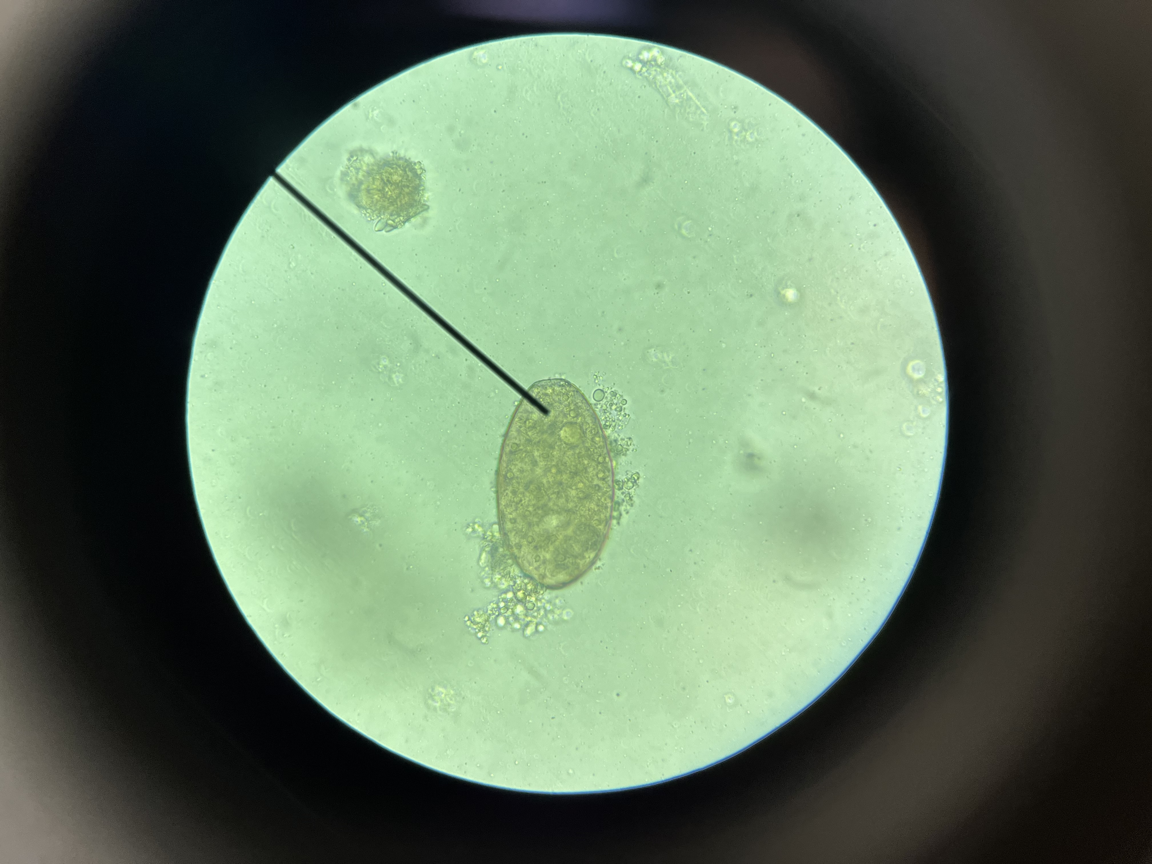 <p>Operculum, no terminal knob</p>