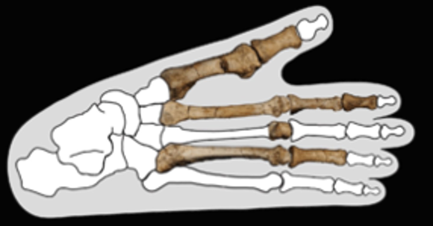 <p>- A dextrous big toe</p><p>- Prognathic jaw</p><p>THINK: "Medias"</p>