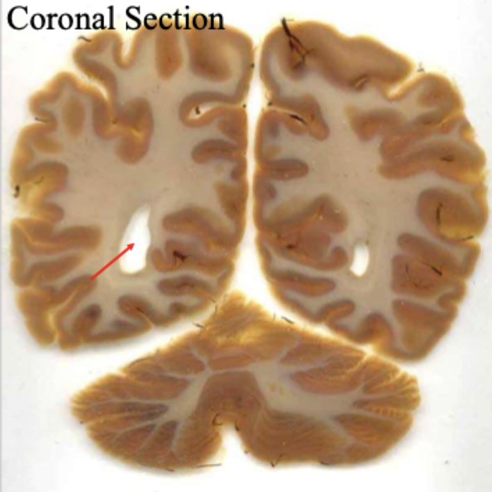 <p>what is the red arrow pointing to?</p>