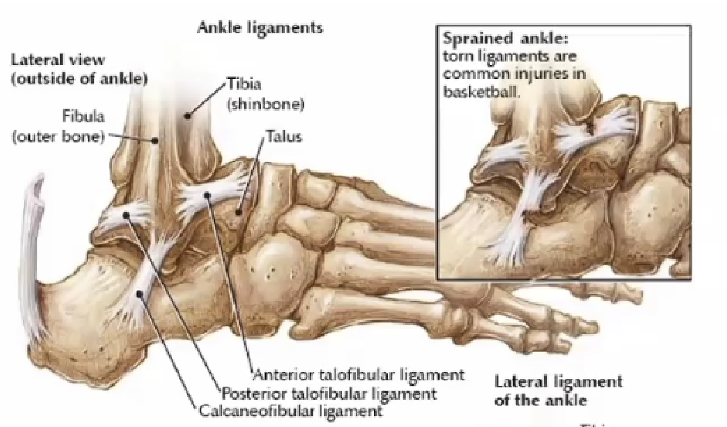 <p>CALCANEOFIBULAR ligament</p>