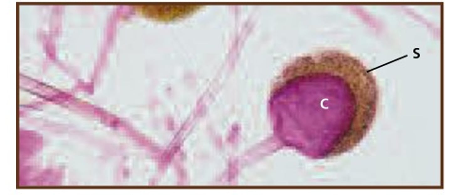 <p>a specialized sac, case, or capsule, or other structure found on top of the sporangiophore that produces spores.</p>