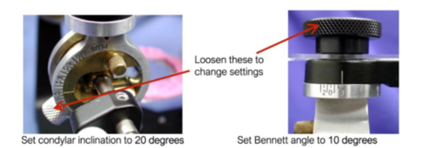 <p>Bennet angle to 10 degrees and condylar inclination to 20 degrees</p>