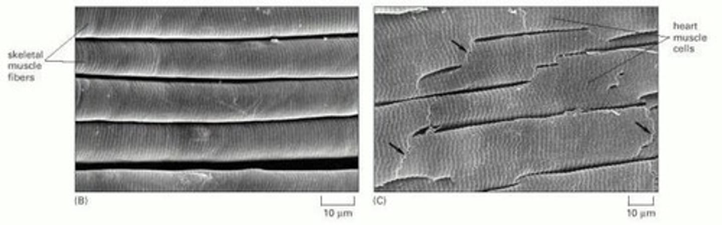 <p>Branching, mononucleate cells with myofibrils.</p>