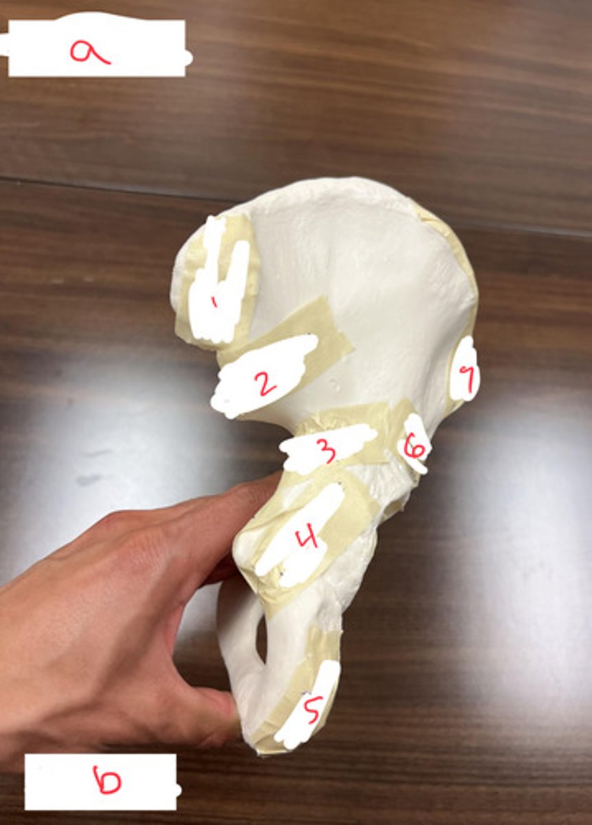 <p>what view of the ox coxae is this?</p>