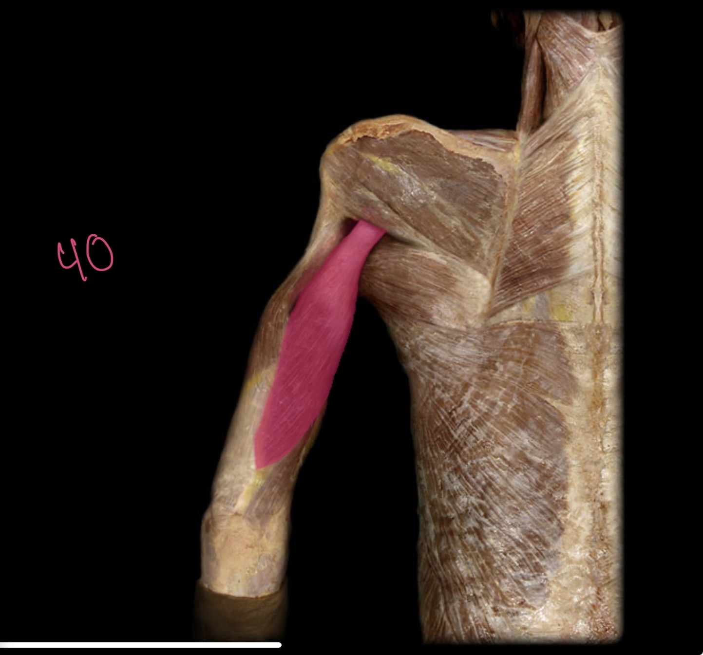 <p>Long head of triceps brachii</p>