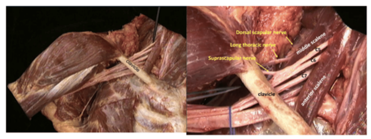 <p>Supraclavicular branches</p>