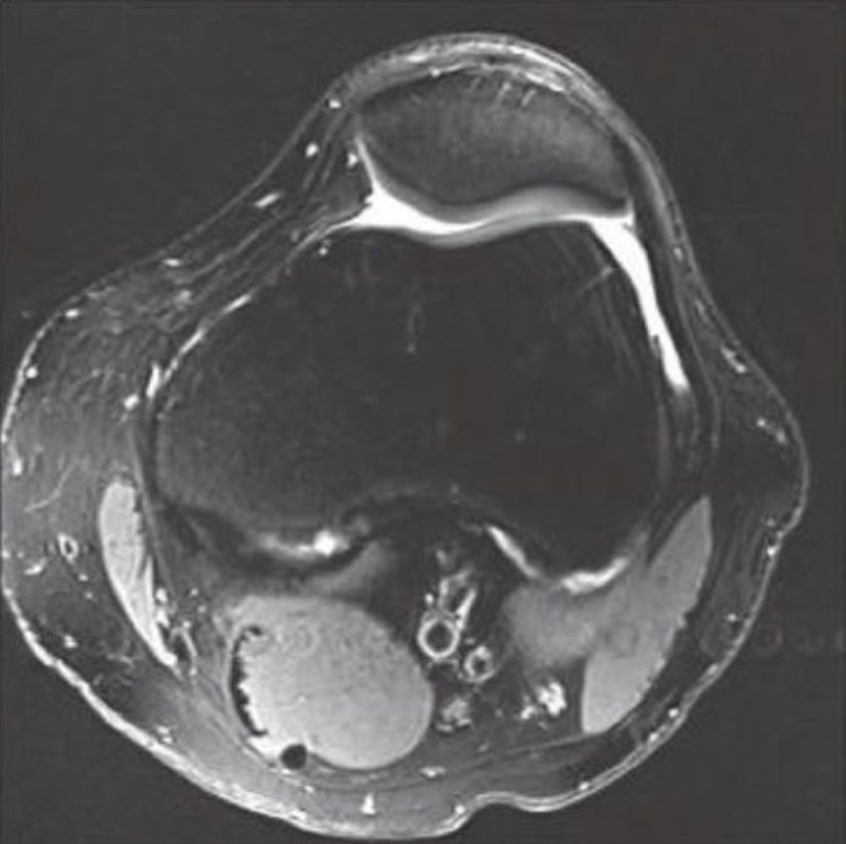 <p>looks like tangential x-ray<br>- see tibial plateau</p>