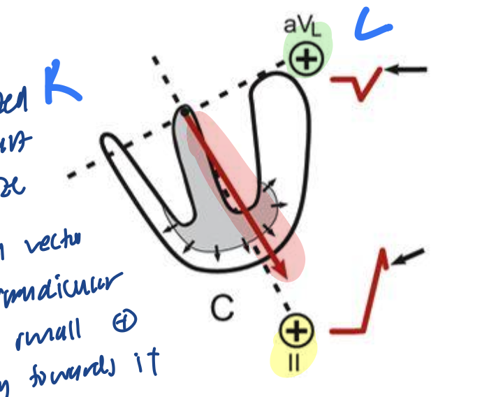 <p><strong>The Electrocardiogram</strong></p><p>What is happening here?</p>