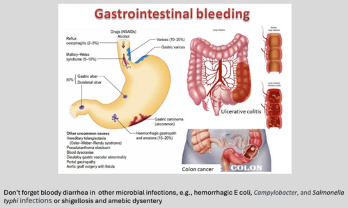<p>if you see blood in stool, these are GI conditions that will cause it:</p>