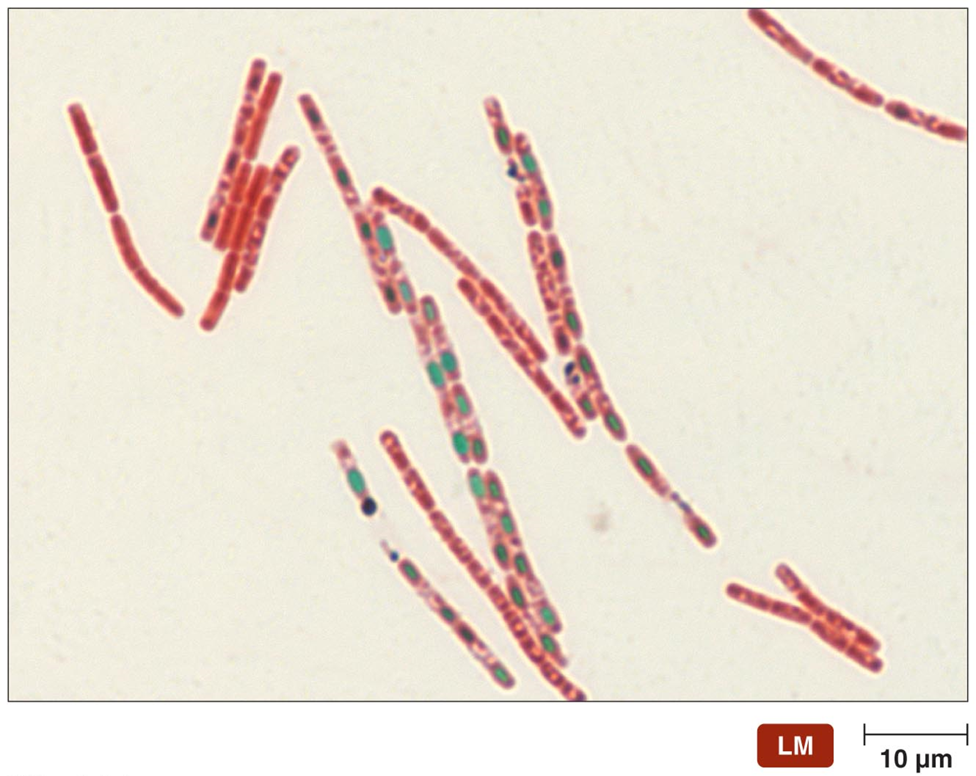 green = endospore
pink = vegetative cell