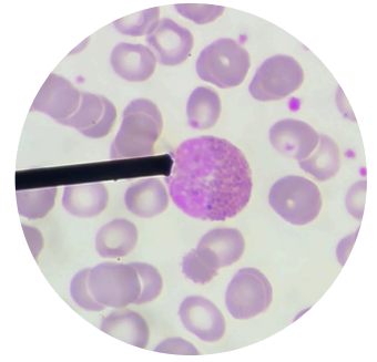 <p>what kind of white blood cells is this?</p>