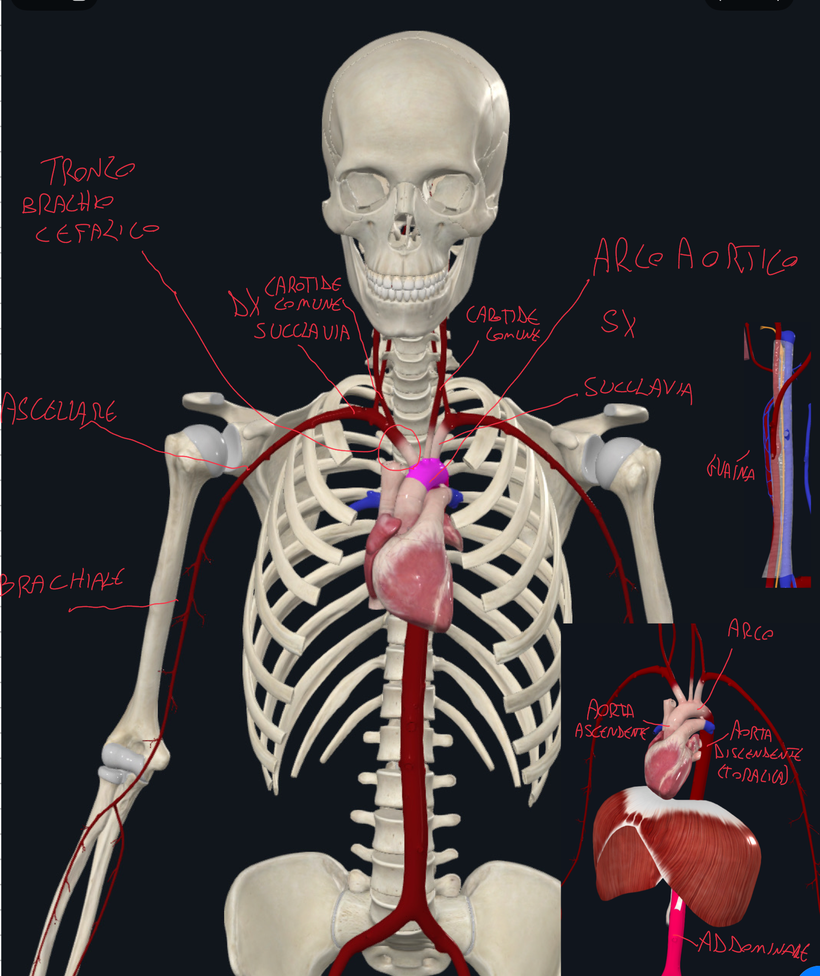 <p>AORTA:</p><ul><li><p>Principale arteria del grande circolo, da cui originano tutte le arterie</p></li><li><p>Origina dal ventricolo sinistro</p></li><li><p>Suddivide in Aorta Ascendente → Arco Aortico → Aorta Discendente (toracica e poi addominale dopo aver attraversato il diaframma)</p></li></ul><p>L’arco aortico origina 3 rami:</p><ul><li><p>Sul lato destro → Tronco brachiocefalico che si divide in → Carotide comune destra e Succlavia destra</p></li><li><p>Sul lato sinistro → Carotide comune sinistra e Succlavia Sinistra (che originano direttamente dall’arco)</p></li></ul><p>Il TRONCO BRACHIOCEFALICO:</p><ul><li><p>il nome indica la destinazione dei suo vasi</p></li><li><p>BRACHIO → la Succlavia è la principale arteria dell’arto superiore (continua con l’arteria ascellare e brachiale)</p></li><li><p>CEFALICO → la Carotide comune assicura irrorazione a testa e collo (dividendosi in carotide interna ed esterna)</p></li></ul><p></p><p>N.B.</p><p>Fascio vascolo nervoso del collo → carotide comune + vena giugulare interna + nervo vago rivestiti da guaina carotidea (connettivo)</p>