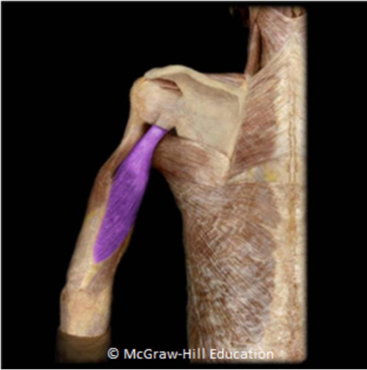 <p>Infraglenoid tubercle of scapula</p>