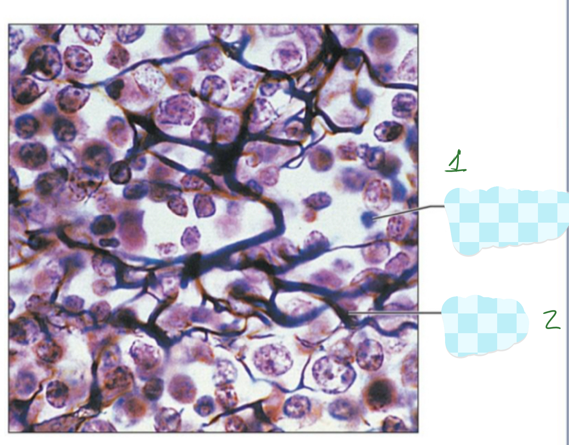 <p>2) reticular ct</p>