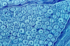 cross section of axons