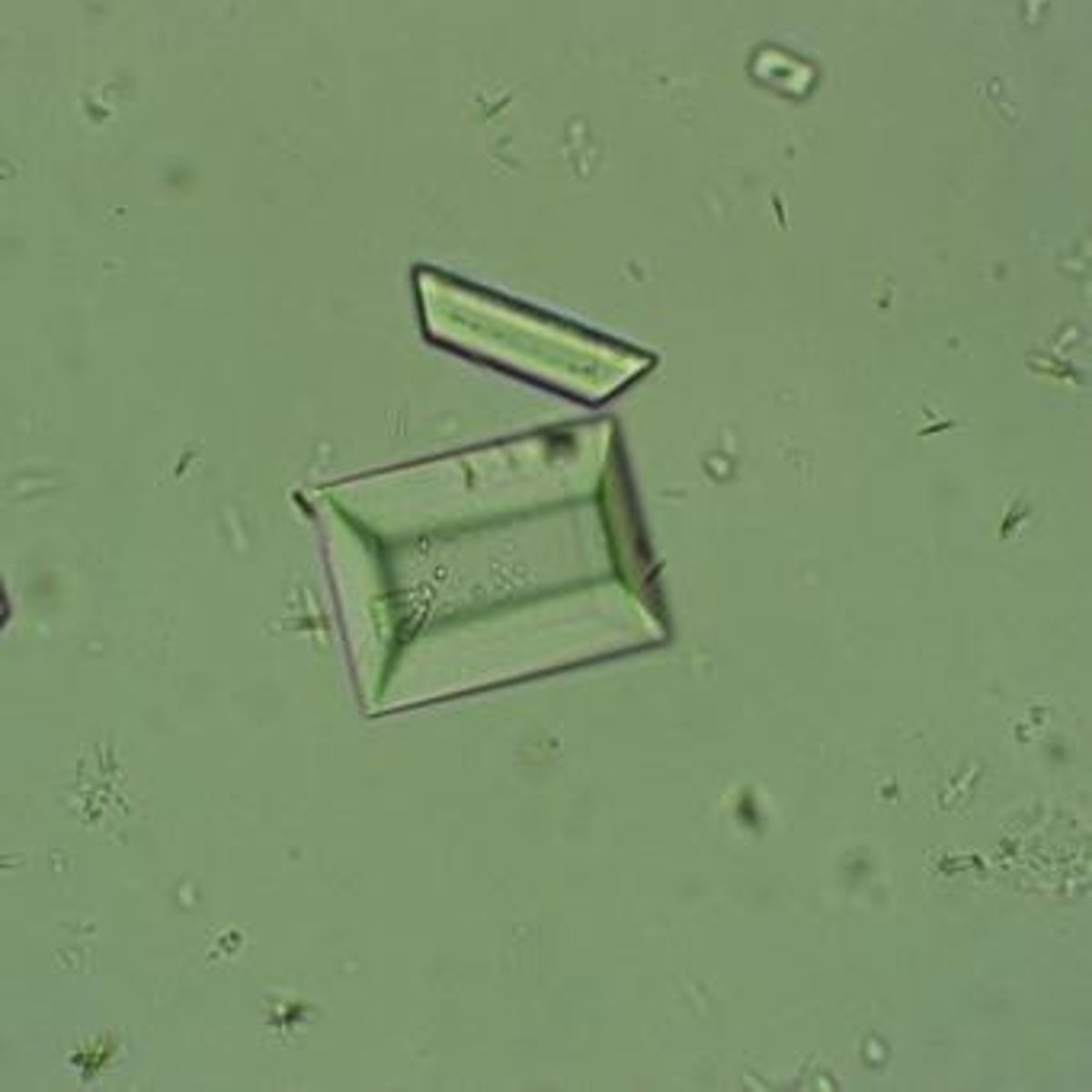<p>Colorless, vary in size, observed under Brightfield at 40x.</p>