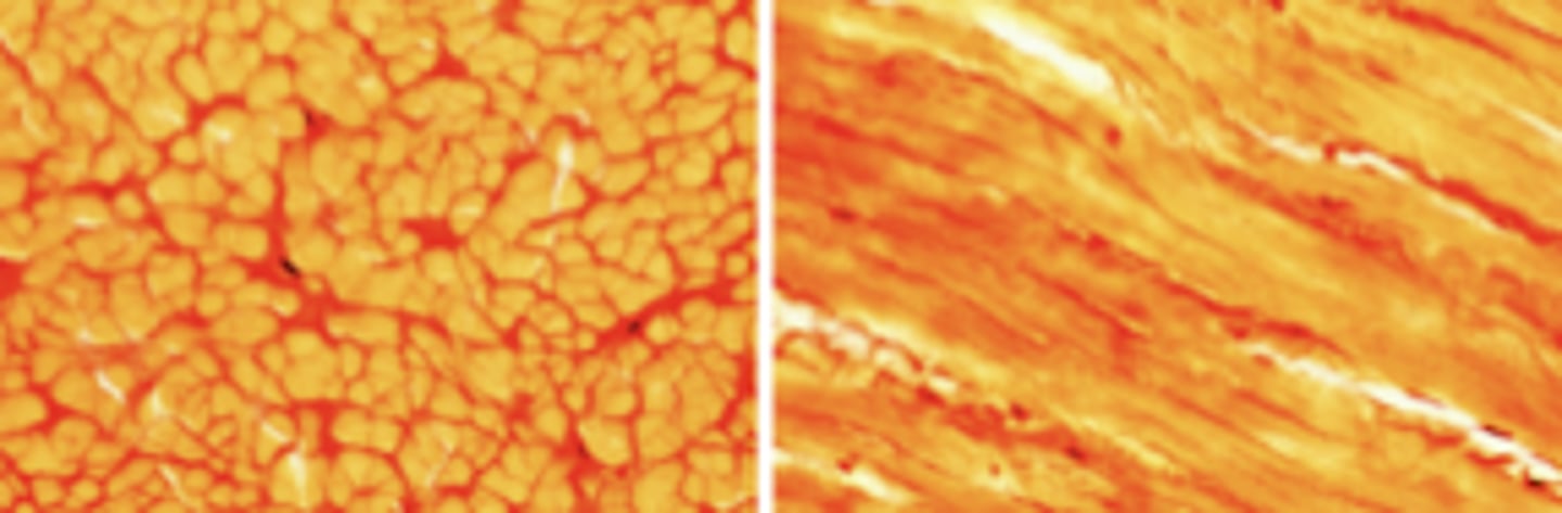 <p>What tissue type is this?</p>