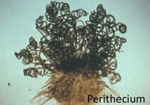 <p>Sordariales: Chaetomiaceae</p>