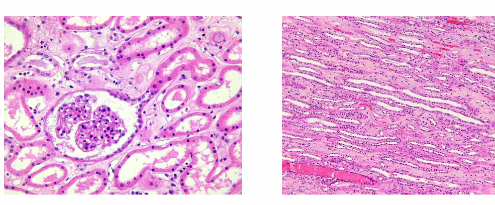 <p>Es l’espai que hi ha entre els glomèruls i les estructures tubulars. • Més prominent a la mèdula. </p><p>FUnción:</p><ul><li><p>Síntesis d’eritropoietina </p></li></ul><p>Format per </p><ul><li><p>fibroblastes</p></li><li><p>fibres col·làgenes </p></li><li><p>matriu de proteoglicans.</p></li></ul><p></p>