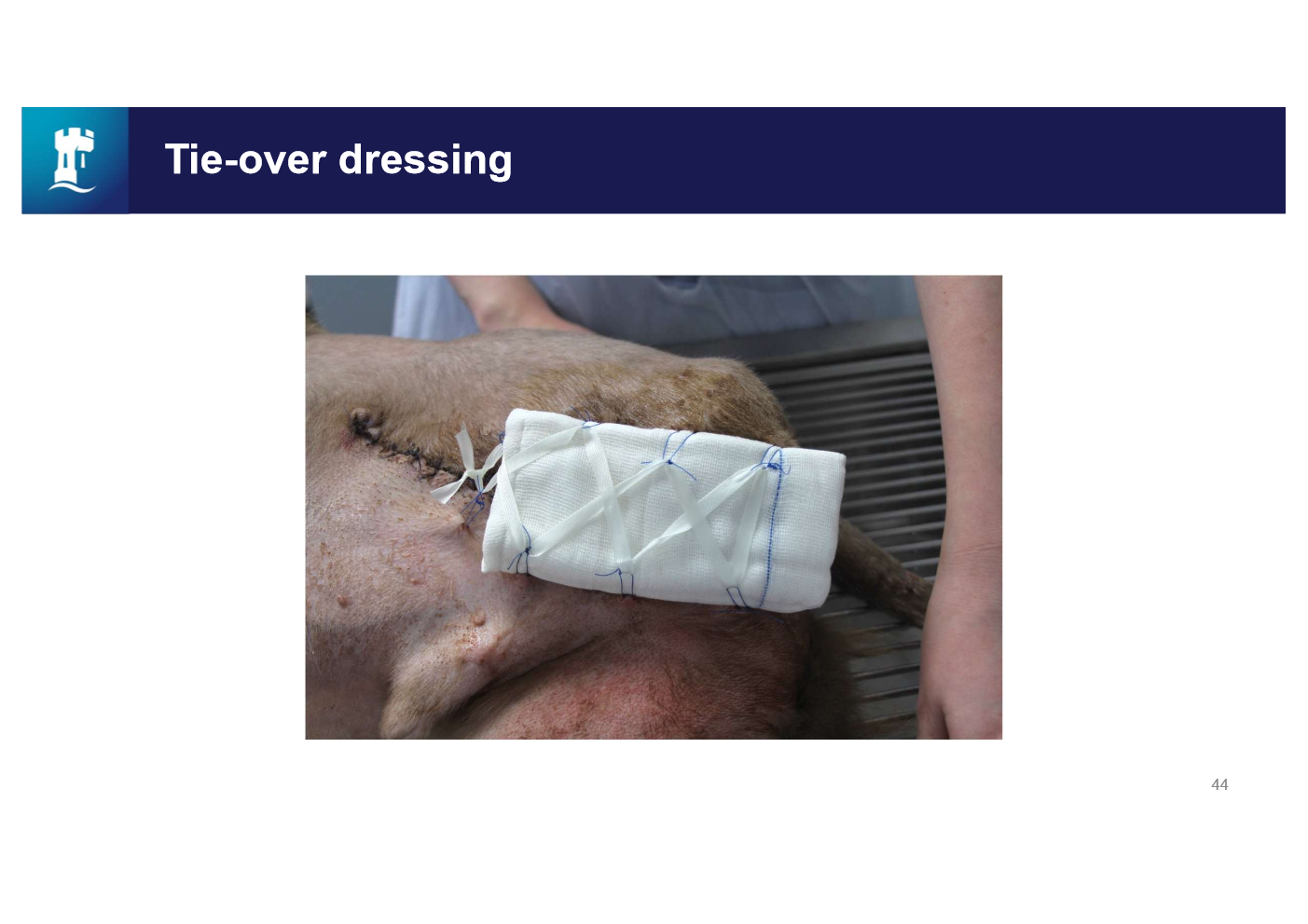 <p>A dressing placed over a skin graft and tied on by sutures that have been left long enough for that purpose</p><p><span><span>&nbsp;</span></span>put dressings over the top and use the loops to tie in the dressing</p>