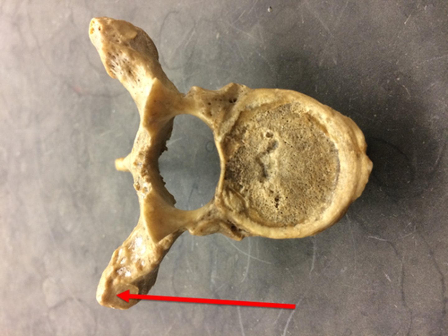 <p>Thoracic vertebra - rib articulation</p>
