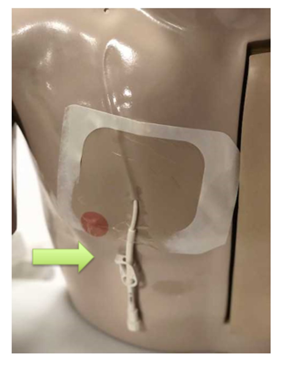 <p>What does image show?</p>