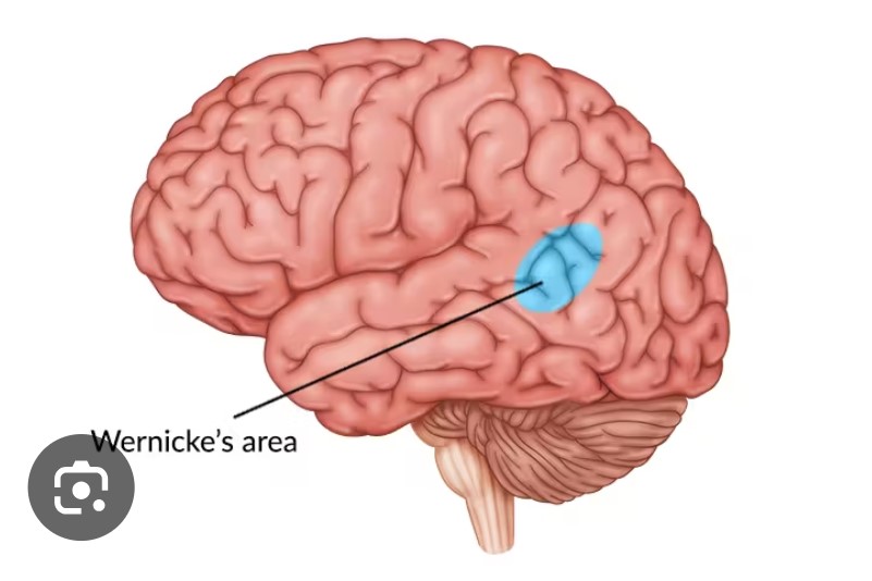<p><mark data-color="#cc8989" style="background-color: rgb(204, 137, 137); color: inherit;"><span>Wernicke's area</span></mark><span> is </span><strong><mark data-color="rgba(0, 0, 0, 0)" style="background-color: rgba(0, 0, 0, 0); color: inherit;">a region of the brain in the temporal lobe, typically on the left side, that is crucial for the comprehension of language, both written and spoken. </mark></strong><span>Damage to this area can result in a condition called Wernicke's aphasia, characterized by fluent but nonsensical speech, difficulty understanding what others are saying, and a lack of awareness that their own speech is meaningless</span></p>