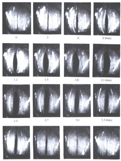 <p>A series of high-speed </p><p>cinematography for one cycle </p><p>of glottal action on phonation</p><p></p>