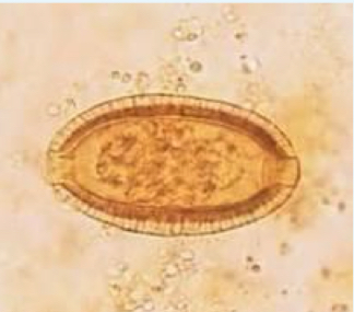 <p>Capillria philippinensis ova</p>