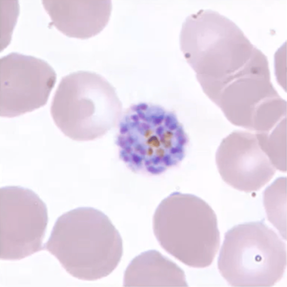 <p>(2) malarial parasite</p><p>ring form: occupies 1/3 of RBC; ring with ONE or TWO CHROMATIN DOTS</p><p>trophozoite: AMOEBOID form</p><p>schizont: FILLS RBCs</p><p>gametocyte: round or oval</p>