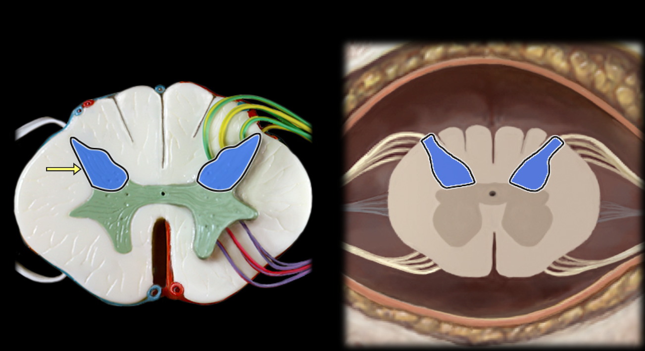 <p>Dorsal horn of spinal cord</p>