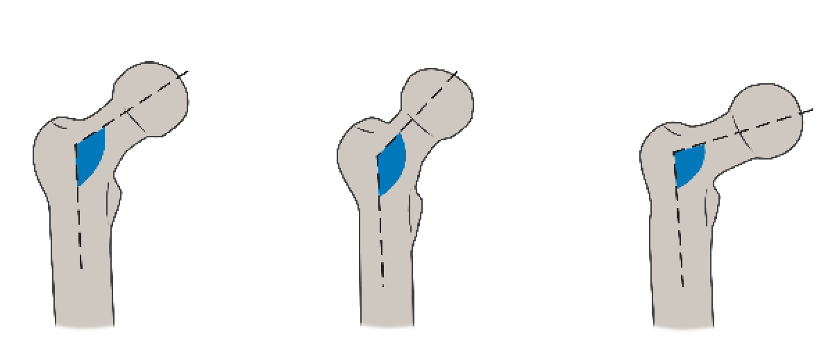 <p>what is displayed by the image on the right?</p>