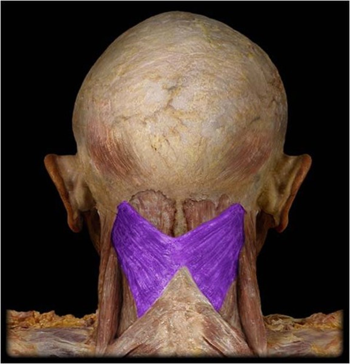 <p>Extends head</p>