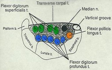 \-Contents: Median nerve, FPL tendon, 4 tendons of FDS, 5 tendons of FDP

\-Floor: Carpal Bones

\-Roof: Transverse carpal ligament (aka flexor retinaculum)

(PIC: supinated view)