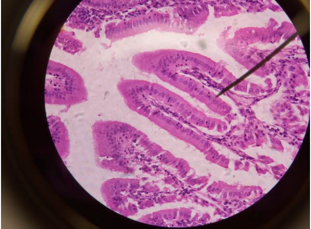 <p>simple columnar epithelial tissue</p>