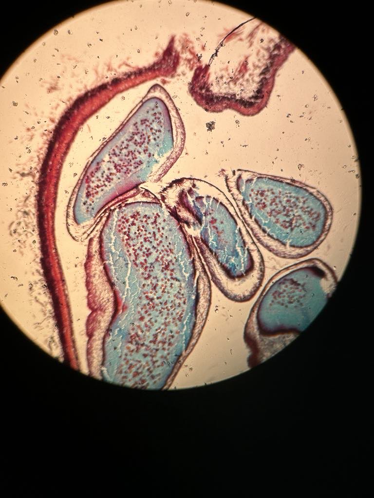 <p>brödkorgssvamp</p>