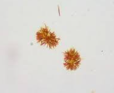 <p>Bilirubin</p>