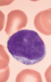 <ul><li><p>A type of White blood cell (Leukocytes)</p></li></ul><p></p><p><u>Agranulocytes</u></p><ul><li><p>Second most abundant WBC, make up 25% of leukocytes</p></li><li><p>Few are found in blood, mostly found in Lymphoid tissue (ex: lymph nodes, spleen, etc.)</p></li><li><p>Crucial to immunity</p></li><li><p>Two types:</p><ul><li><p><strong>T lymphocytes (T cells):</strong> act against virus-infected cells and tumor cells</p></li><li><p><strong>B lymphocytes (B cells):</strong> give rise to plasma cells, which produce <strong>antibodies</strong></p></li></ul></li></ul><p>Characteristics:</p><ul><li><p>Large dark purple nucleus that takes up most of the cell volume; spherical or might have a slight indent</p></li><li><p>Pale blue cytoplasm around nucleus </p></li></ul><p></p>