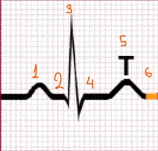 <p>Describe briefly all the steps in a ECG?</p>