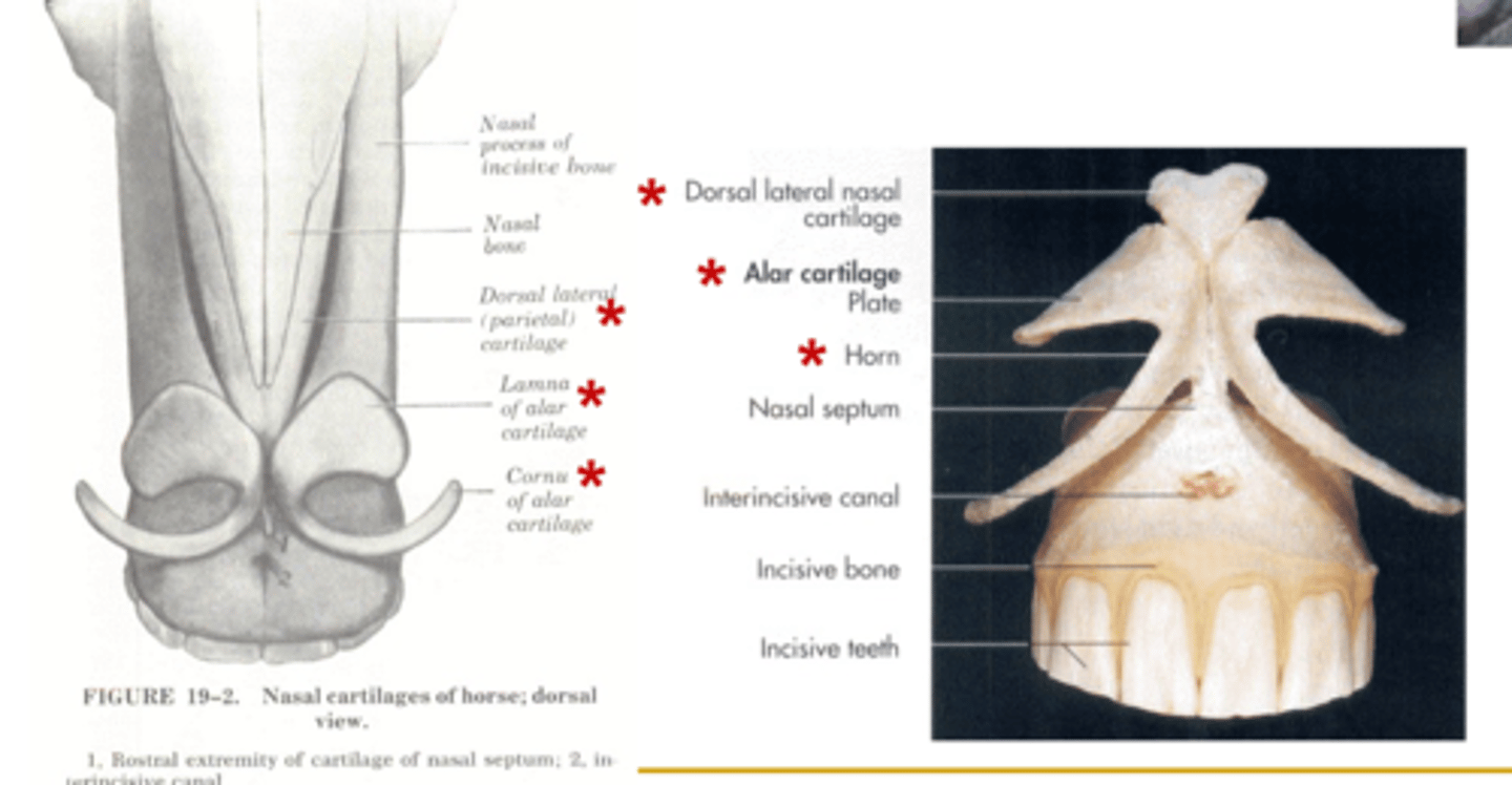 <p>- Lateral: Skin, muscles, fibrous CT</p><p>- Medial: Cartilaginous base (Dorsal lamina of alar cartilage and ventral cornu of alar cartilage)</p>