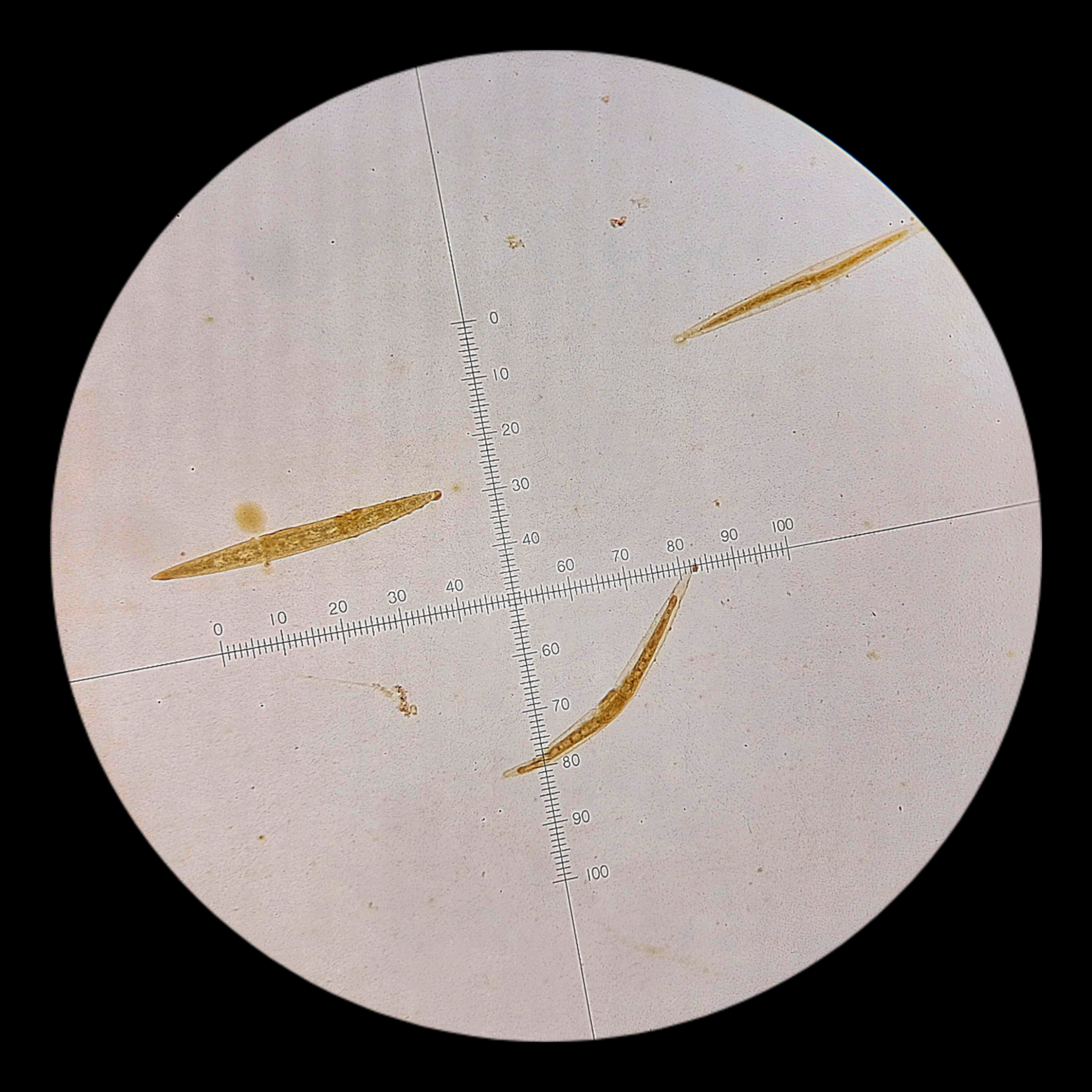 <p><strong><em>Closterium</em></strong></p><p><strong>Phylum: ?</strong></p>