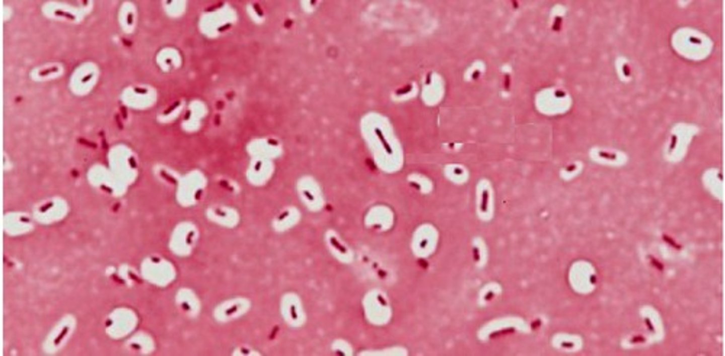 <p>What type of stain is this?</p>