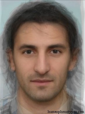 <p>Identify this Phenotype</p>