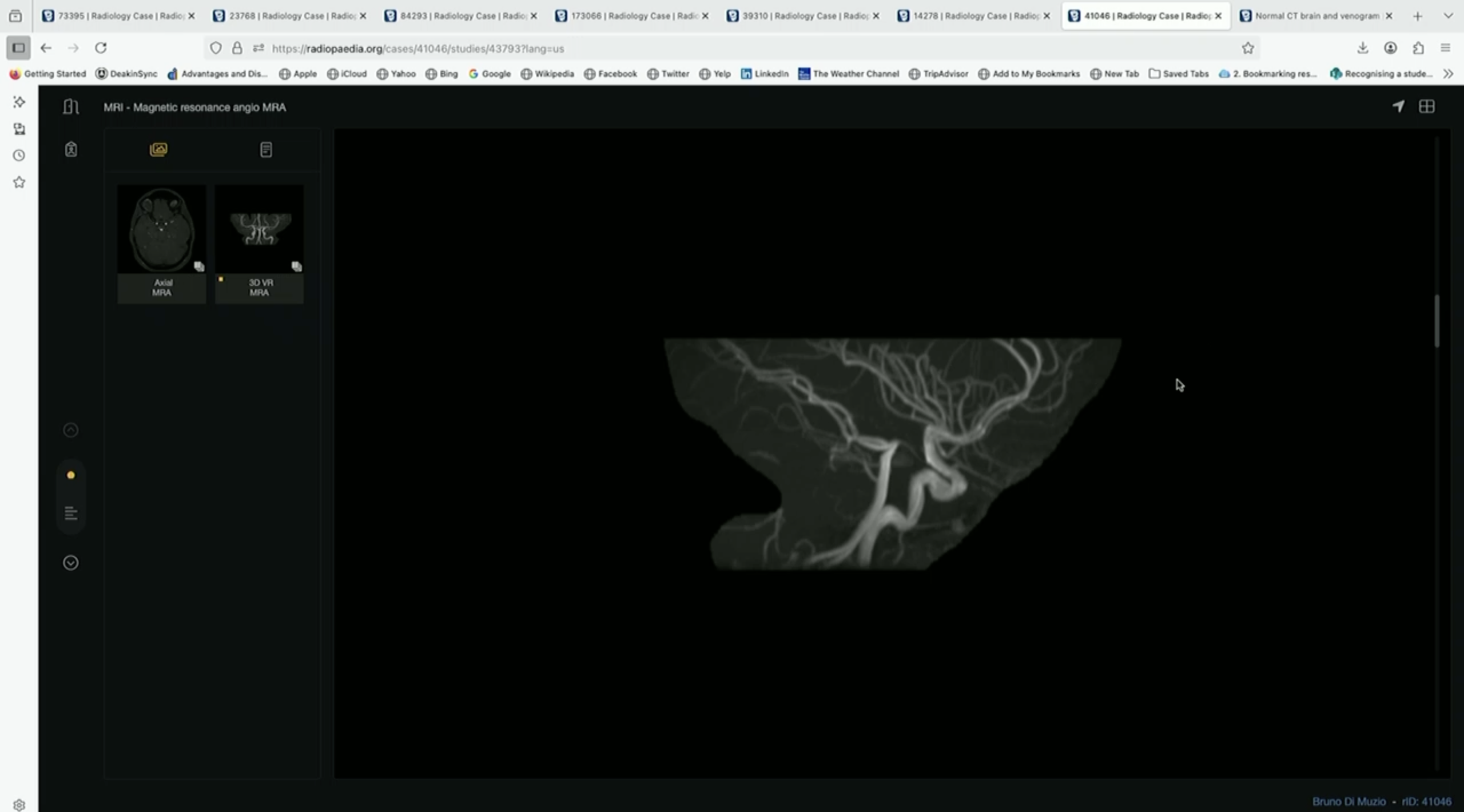 <p>What is the orientation + what are these vessels?</p>