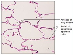 <p>Specific types = Keratinized - contain the protective protein keratin; surface cells are dead and full of keratin; Non-keratinized - forms moist lining of body openings • Function - Protects underlying tissues in areas subject to abrasion • Location = Keratinized - forms epidermis, Non-keratinized - forms lining of esophagus, mouth, and vagina</p>