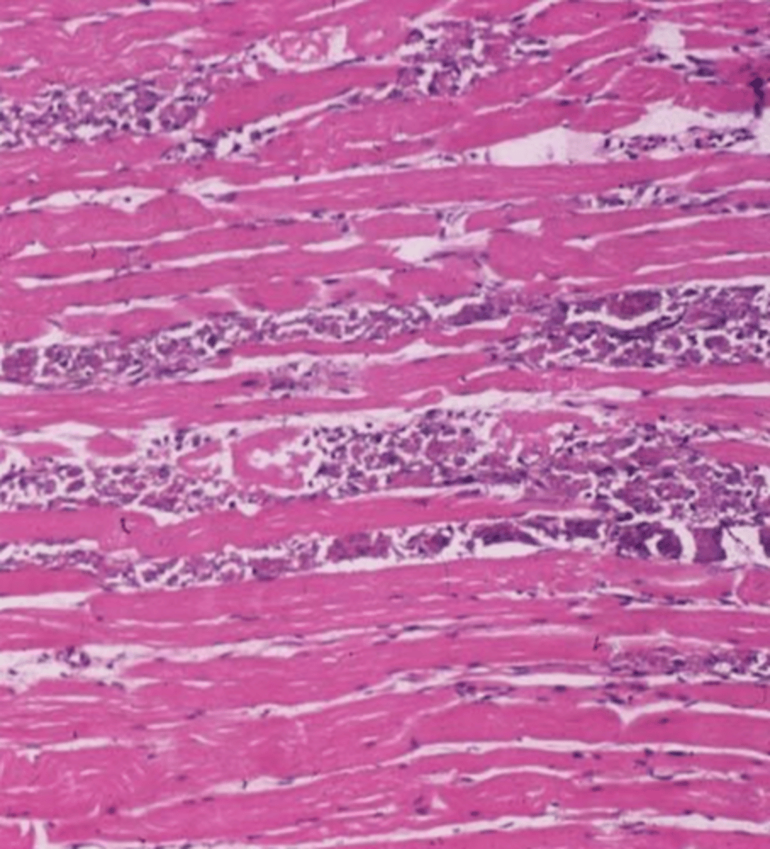 <p>is this dystrophic or metastatic?</p>
