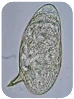 <ul><li><p>diagnostic stage </p></li><li><p><span><u>very large, 116-180 x 45-58 um</u></span></p></li><li><p><span>Thin, smooth shell</span></p></li><li><p><span><u>Indistinct operculum</u></span></p></li><li><p><span><u>Prominent lateral spine</u></span></p></li><li><p><span><u>Embryonated when passed</u></span></p></li></ul><p></p>