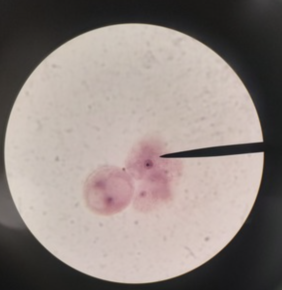 <ul><li><p>identify</p></li><li><p>m.o.t</p></li><li><p>infective stage</p></li><li><p>host</p></li></ul><p></p>